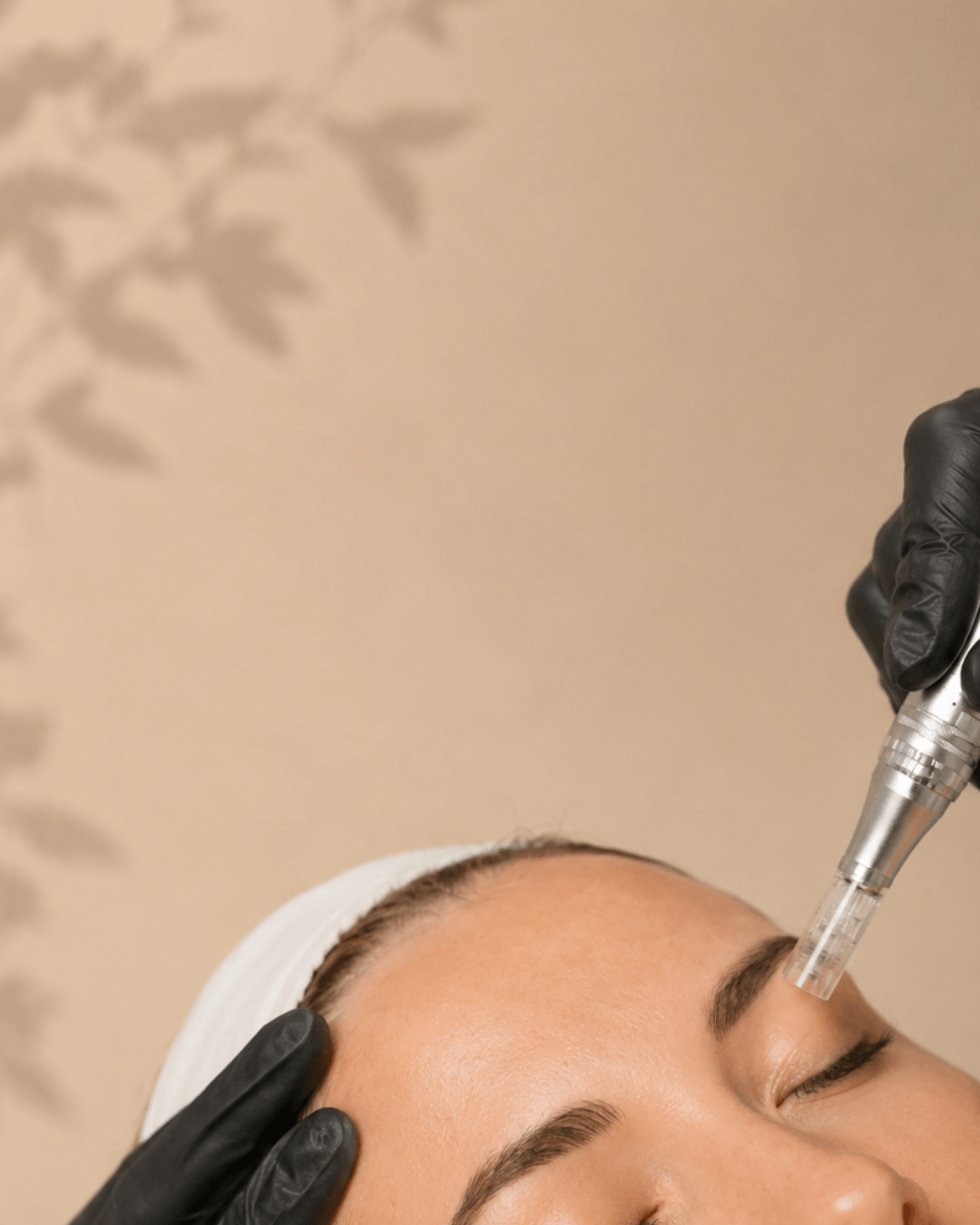 Egzosomi i microneedling